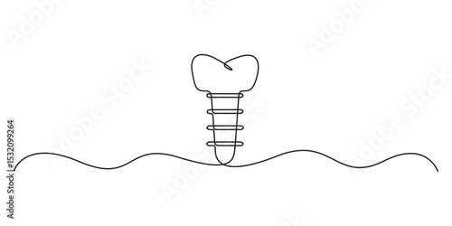 Continuous one line drawing of vector illustration of dental implant, isolated on white background. Line art of dental implant. Vector illustration