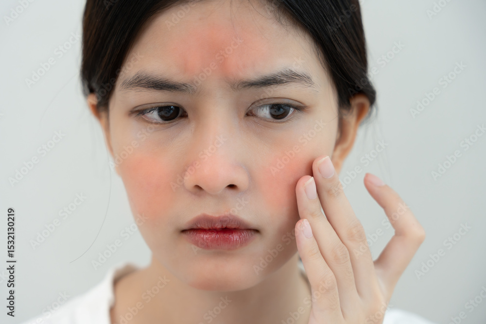Young woman are worried about faces Dermatology and allergic to steroids in cosmetics. sensitive skin, red face from sunburn, acne, allergic to chemicals, rash on face. skin problems and beauty Young woman are worried about faces Dermatology and allergic to steroids in cosmetics. sensitive skin, red face from sunburn, acne, allergic to chemicals, rash on face. skin problems and beauty