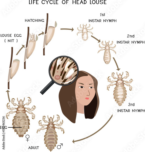 Life cycle of head louse (Pediculus humanus) insect isolated on white background. Growth stages from louse egg (nit) to adult insect for biology lesson