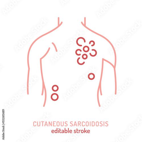 Cutaneous sarcoidosis icon, pictogram. Editable vector illustration