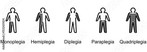 Paralysis Types banner web icon vector illustration of Monoplegia, Hemiplegia, Diplegia, Paraplegia, Quadriplegia