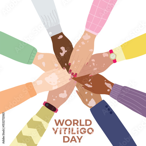 World vitiligo day June 25 banner. Diversity hands with vitiligo skin disease stacking together. Body positive concept. Hand drawn vector illustration