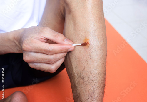 man thins has leg pain