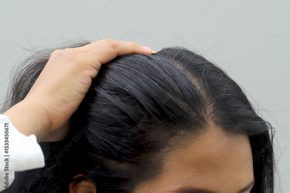 Naklejka premium Woman with hair loss dryness and frizziness