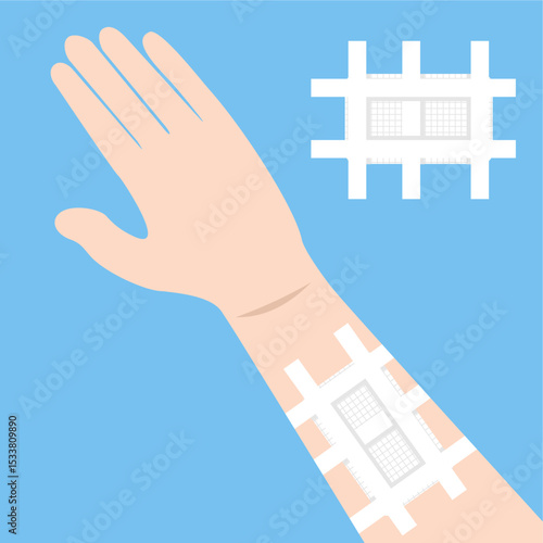 Patient’s arm wrapped in gauze pad,
secured using white adhesive tape,
for wound treatment and first aid,
doctor care, flat design style.