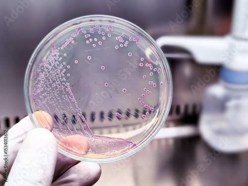 A microbiological culture Petri dish with a colonies of the pathogenic bacterium Escherichia coli (E. coli)