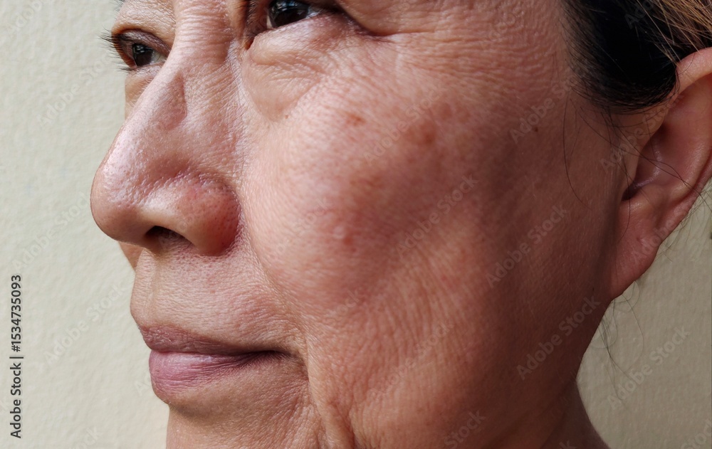 Fototapeta premium portrait the Flabbiness and flabby skin, swelling and ptosis beside the eyelids, dark spots and blemish, melasma and scar, wrinkles and dullness on the face, health care and beauty concept.