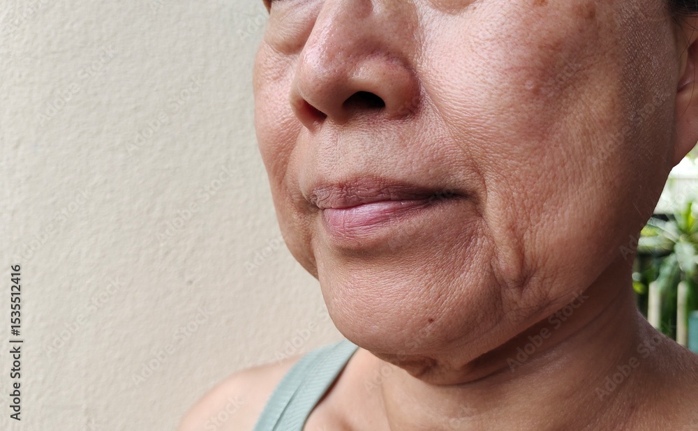 Fototapeta premium portrait the Flabbiness and wrinkle, smile lines and scar beside the mouth, dark spots and blemish, freckles and Flabby skin on the face, health care and beauty concept.