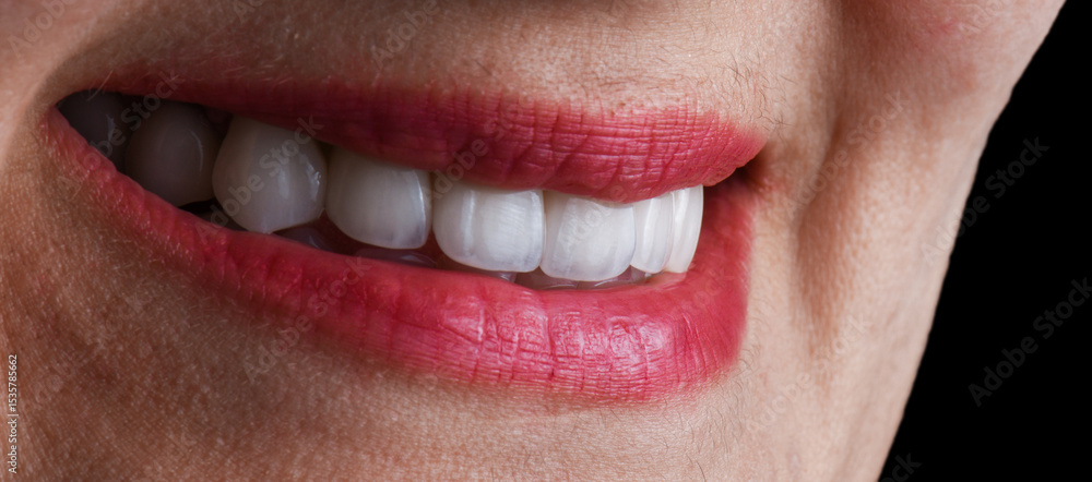 Obraz premium ceramic crowns and veneers