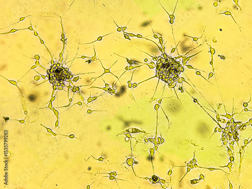 Spheroids of glioblastoma cell culture.