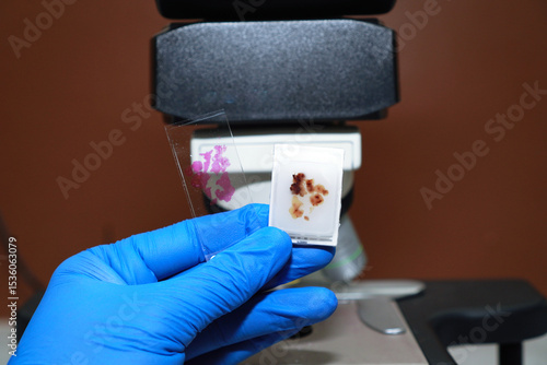 Scientist's hands wearing blue gloves holding paraffin blocks and human tissue slides against a defocused microscope background