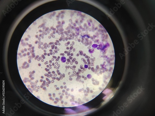 cells under a microscope, inflammation, cancer, neutrophils, macrophages