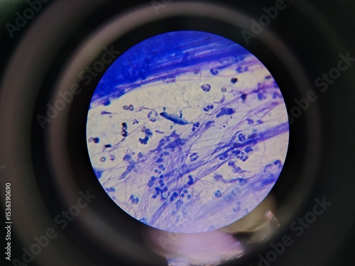 cells under a microscope, inflammation, cancer, neutrophils, macrophages