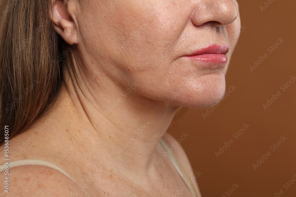 Fototapeta premium Woman before cosmetic procedure on brown background, closeup