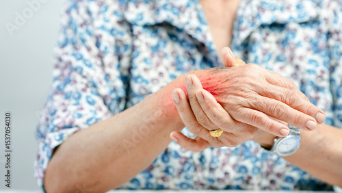 Elderly woman holding painful swollen hand, showing signs of arthritis inflammation, joint pain, and discomfort, wearing floral shirt and gold ring, health and aging concept
