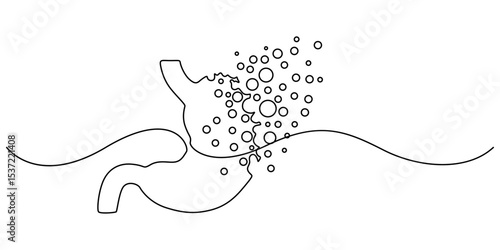upset stomach continuous one line drawing, Continuous Line Drawing Of A Stomach, bad stomach, Upset stomach. Stomachache. Digestive disorder. vector illustration on white background, reflux minimal.