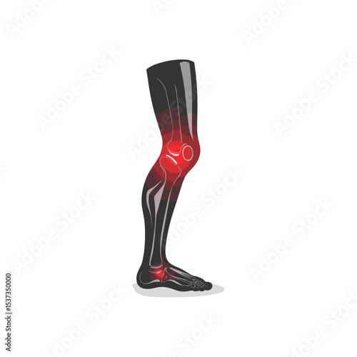 Human leg illustration showing pain in the knee joint area  