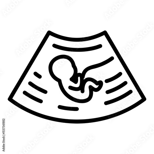 Ultrasound image of a baby, prenatal scan illustration, minimalistic line design