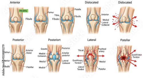 Human Knee Anatomy: Anterior, Posterior, Lateral, and Patellar Views