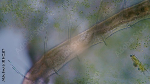 The amazing world of microbiology. Different bacteria, microbes and single-celled microorganisms are visible through a microscope. High-quality video.