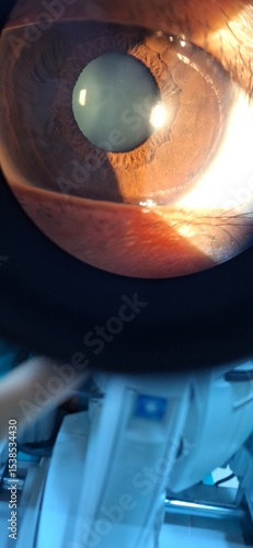 Canvas-taulu eyes on slit lamp