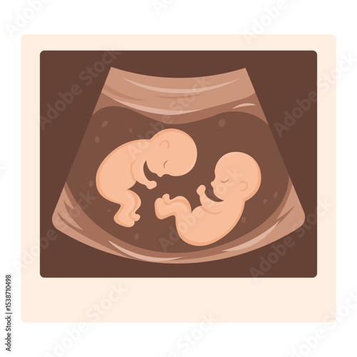 Vector cartoon image of ultrasound scan with baby. Pregnancy management concept. Element for your design