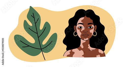 Young dark skinned woman with vitiligo next to a large green leaf