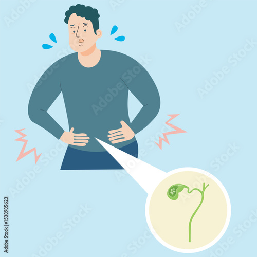 Flat vector illustration showing acute cholecystitis and related gallbladder diseases like gallstones and biliary colic, highlighting inflammation, pain, and digestive distress medical context 