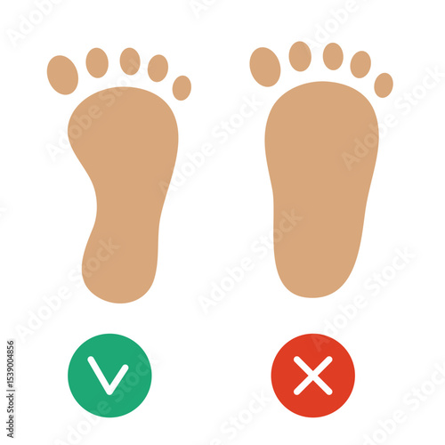 Healthy foot and flatfoot. Vector illustration isolated on white background.