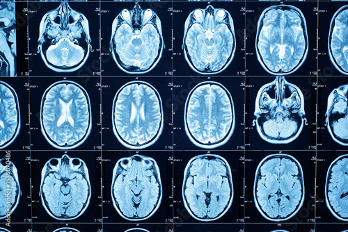 Closeup of a CT scan with brain. Medical, science and education mri brain background. Magnetic resonance imaging.