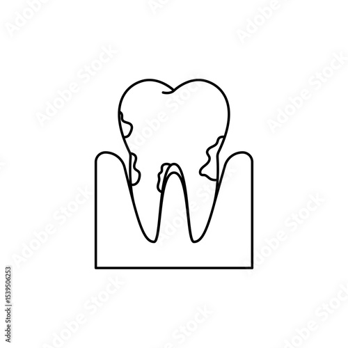 Gum disease