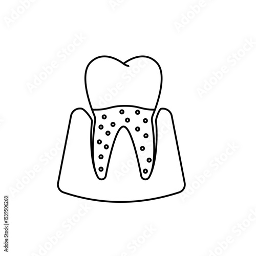 Gum disease