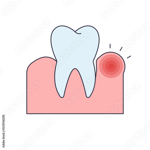 Gum disease