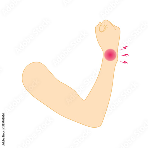 Vector illustration of human hand showing wrist pain with red inflammation and lightning symbols. Suitable for healthcare, injury treatment, physiotherapy, and orthopedic content.