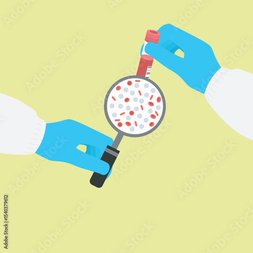 Acute lymphoblastic leukaemia,Children,Teenagers and young adults,myeloid, A flat vector illustration depicting Acute Lymphoblastic Leukaemia, highlighting abnormal white blood cells in blood flow,