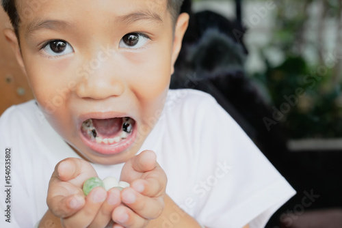 This boy lost his teeth from eating sweets and nibbles, which is likely due to natural loss. His smile reveals gaps where teeth used to be, giving him an attractive, young, and cheerful appearance.