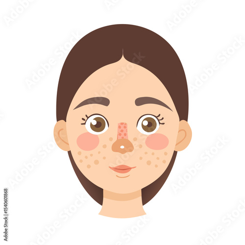 Oily Skin Vector Icon