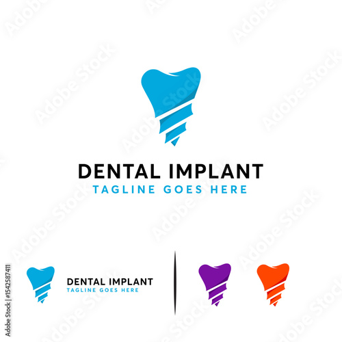 Dental implant  design with a tooth and screw.