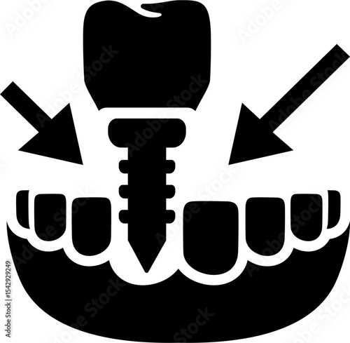 Tooth Transplantation