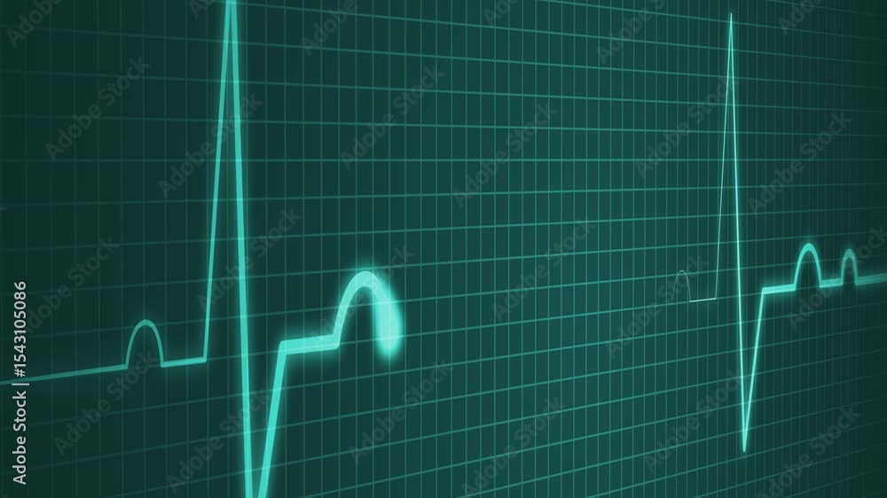 Pulse Line Animation Electrocardiogram Pulse Line Animation for Medical Technology ...