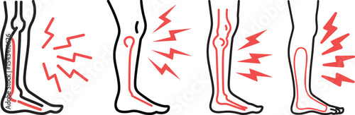 shin hurts icon on white background. flat style. body pain symbol. shin pain sign. Shin hurts thin line icon body pain concept, Calf Muscle Pain - Cramps - Stock Illustration