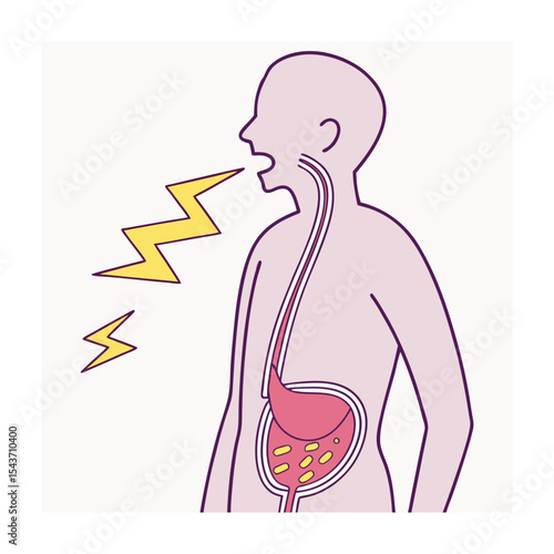 Heartburn and Acid Reflux Illustration: Stomach Acid, Digestive System, and Pain