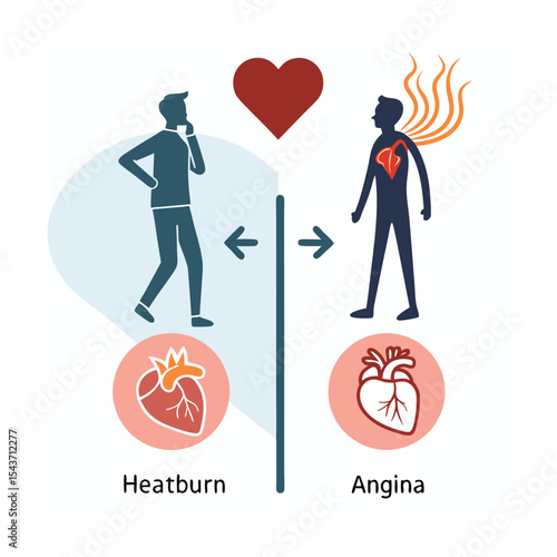 Heartburn vs. Angina: Understanding Chest Pain Symptoms and Medical Differences