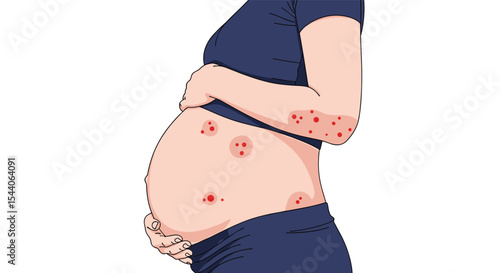 Skin Problems That Appear During Pregnancy Common Causes and Treatment