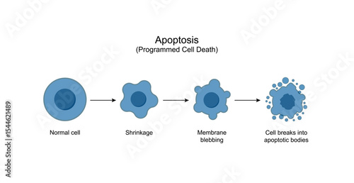Apoptosis. Programmed cell death. Aging process in cells. Stages of apoptosis, normal cell, shrinkage, membrane blebbing, cell breaks into apoptotic bodies and phagocytosis. Vector illustration. 