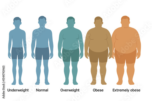 Vector illustration of body mass index ranging from underweight to extremely obese, depicted through male silhouettes with varying obesity levels