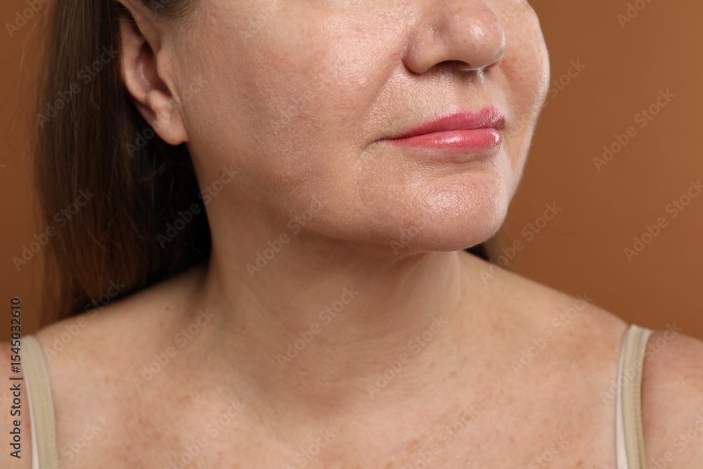 Obraz premium Woman before cosmetic procedure on brown background, closeup