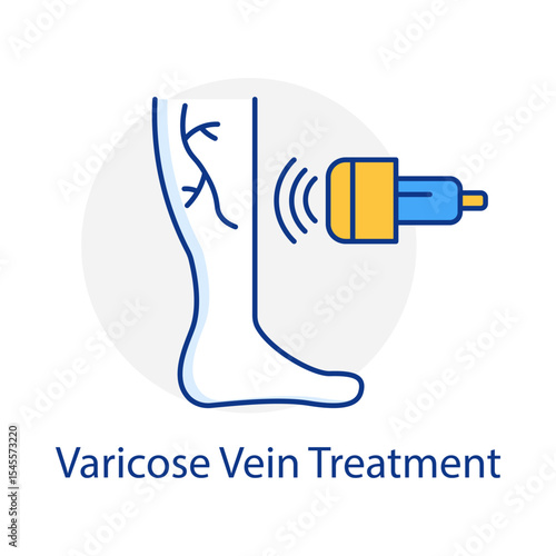 Varicose Vein Treatment – Laser Device Representing Vascular Correction