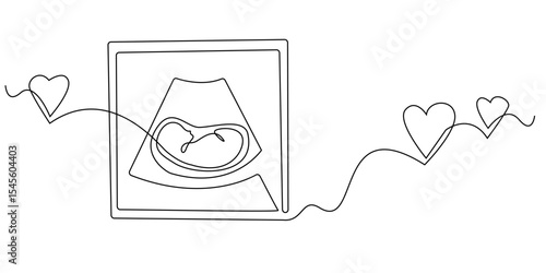 continuous line ultrasound photo of baby.scan photo of baby in the womb.single line illustration.eps 10