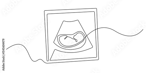 continuous line ultrasound photo of baby.scan photo of baby in the womb.single line illustration.eps 10